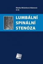 Galén Lumbální spinální stenóza